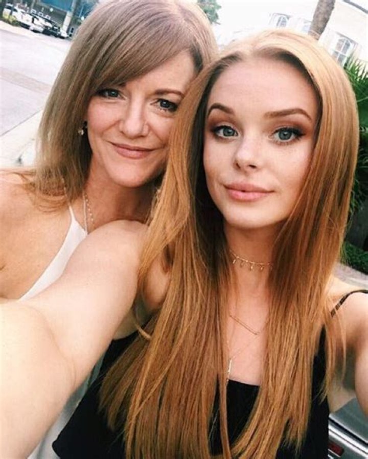 Abigail Cowen Plastic Surgery – Before And After Pictures