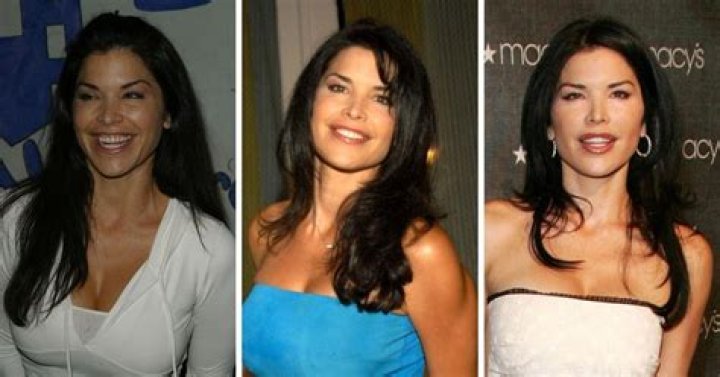 Alexis Maloney Before And After Photos- Plastic Surgery Details
