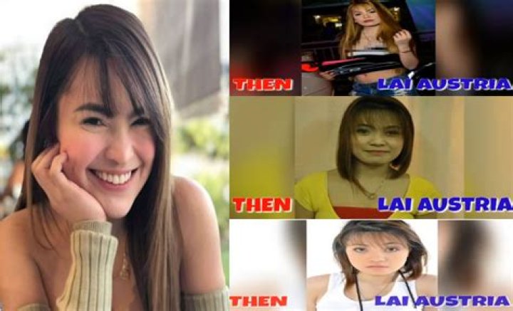 Did Lai Austria Get Plastic Surgery? Before &amp; After Pictures Of The Model
