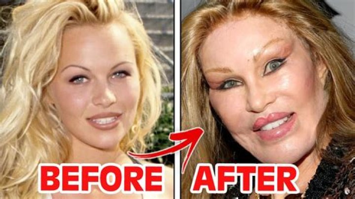 Here Are The Photos Of Kim Lee Before Surgery On Bling Empire, Further Details On The Cosmetic Procedures