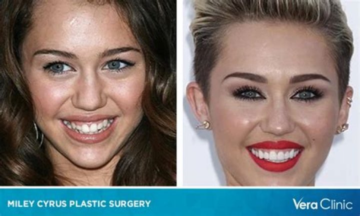Tish Cyrus Plastic Surgery | Before And After Photos