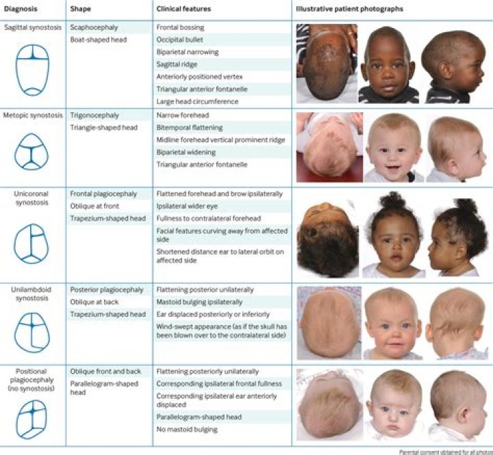 What Happened To Symone Sanders Ear? Abnormal Growth and Health Update